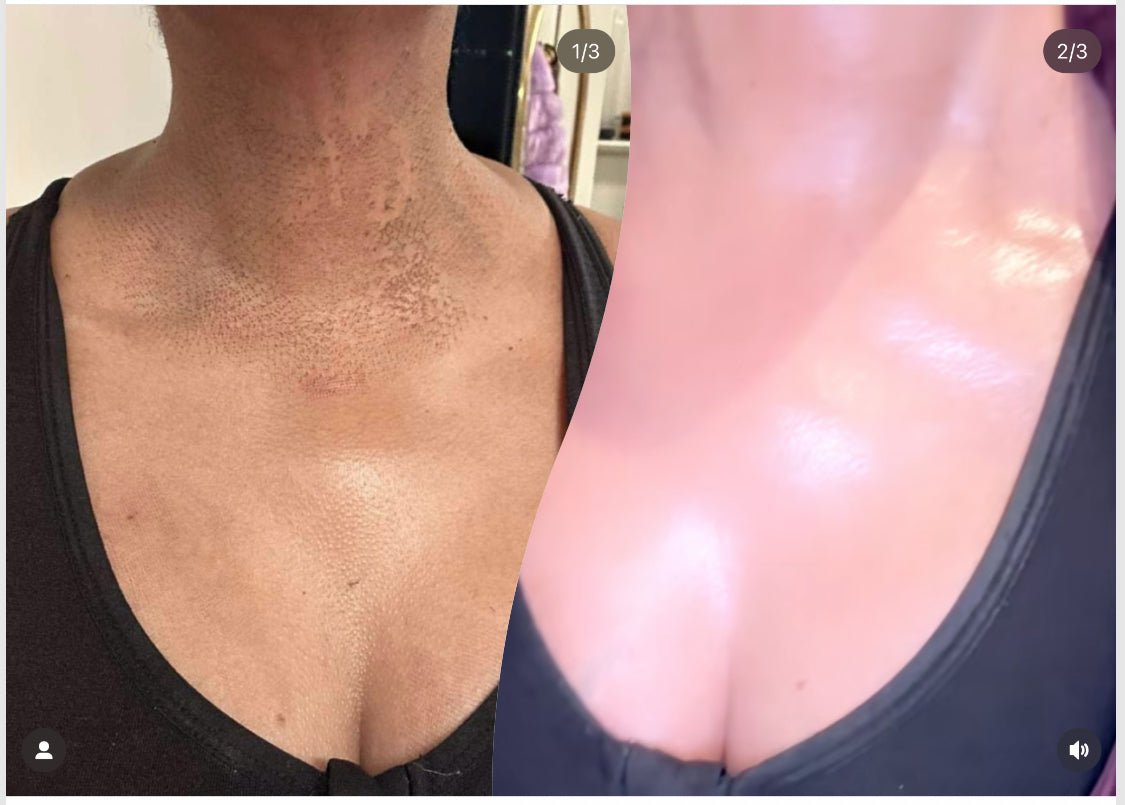 Full Face & Neck Bleaching Cream                                      Blac Chyna                                                       30G | 60G