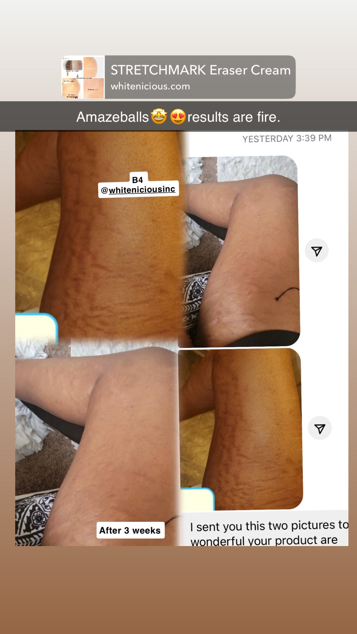 Inner Thigh lightening Cream Set