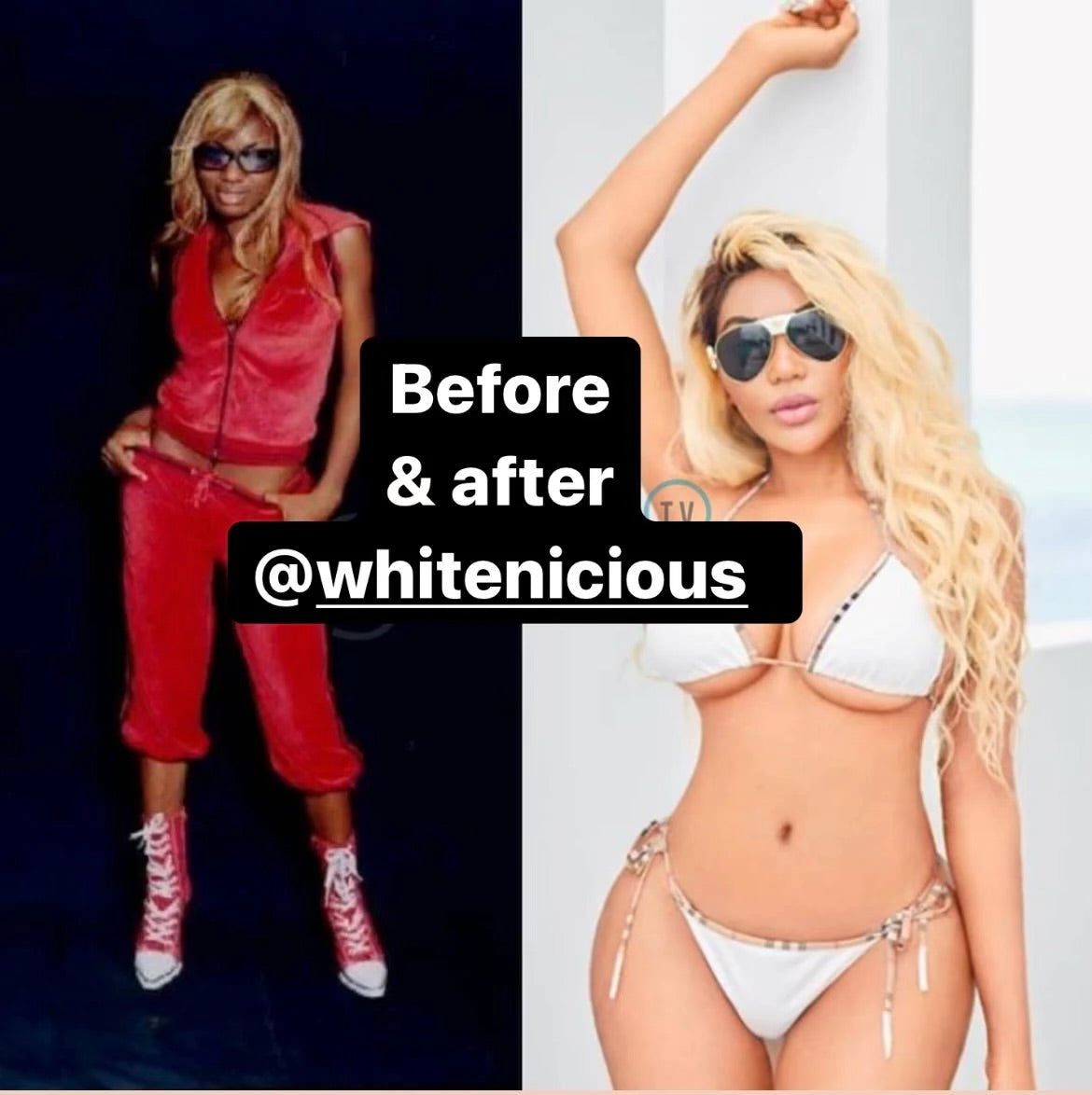 Skin Whitening Shots