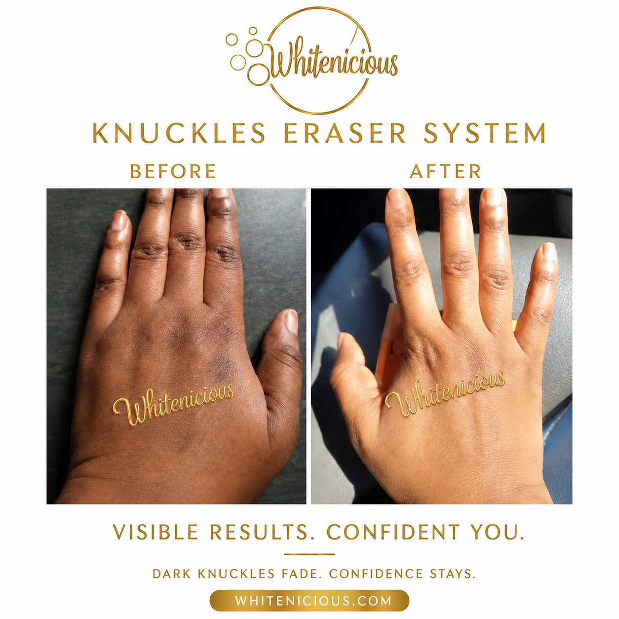 KNUCKLE/ KNEES & ELBOW GLOW UP