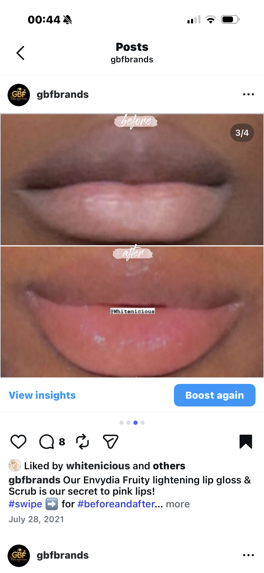 DARK LIP LIGHTENING