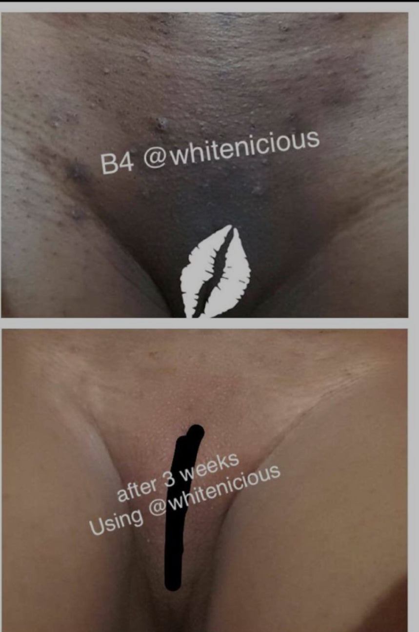 Intimate Area Cream 100Ml