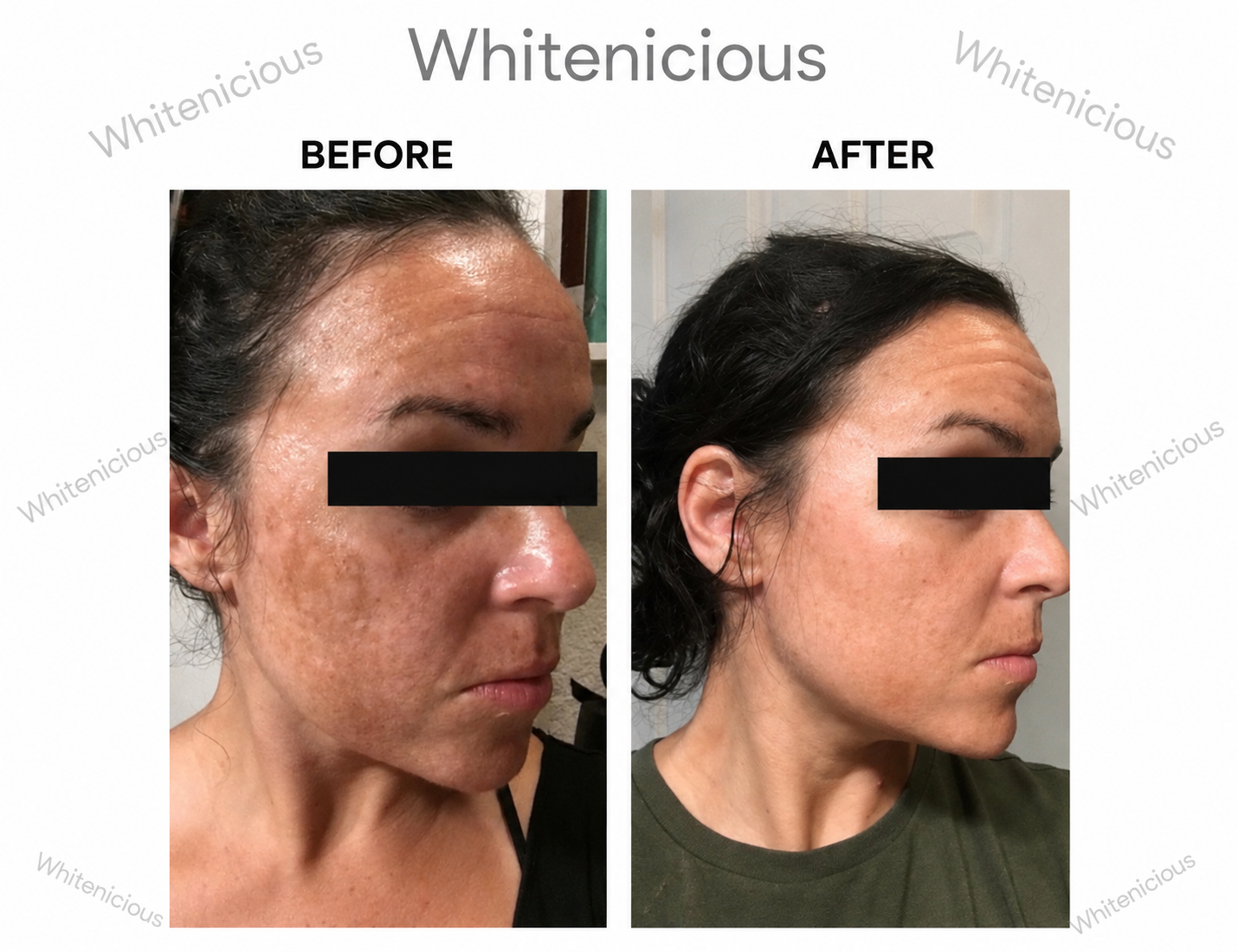 Baddie Skin Elixir