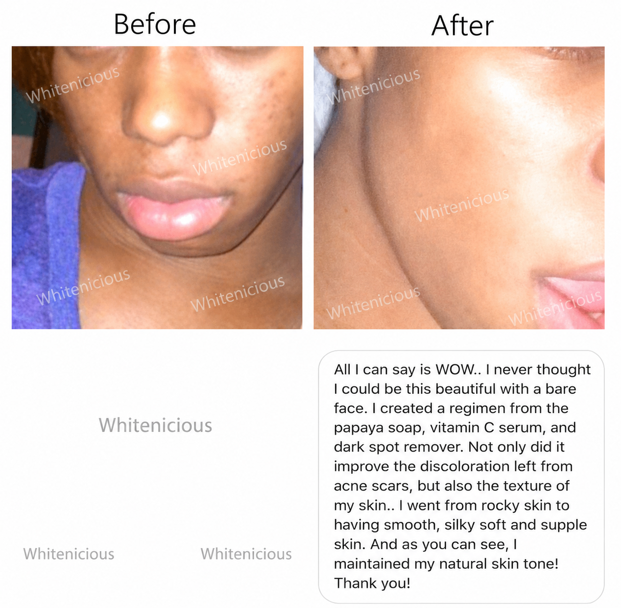 Baddie Skin Elixir
