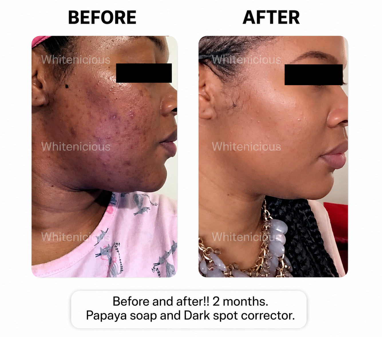 Baddie Skin Elixir