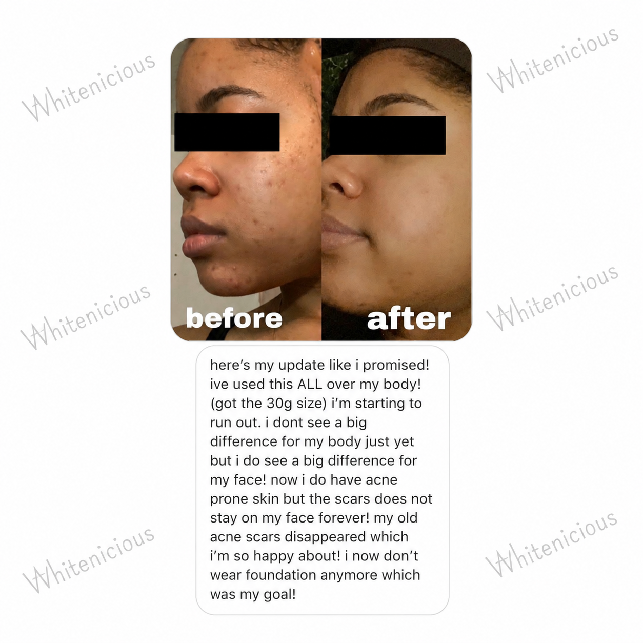 Baddie Skin Elixir