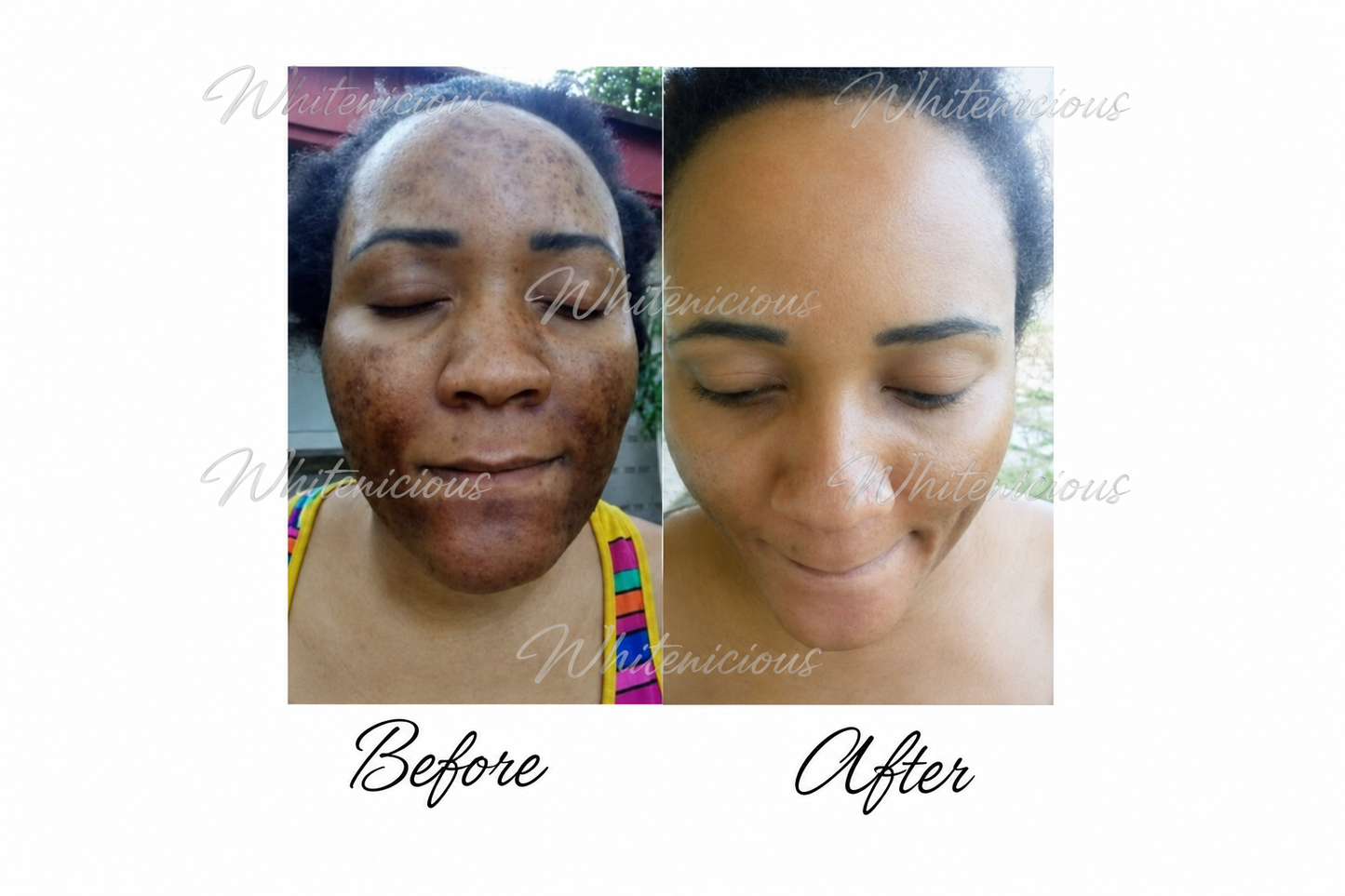 Baddie Skin Elixir