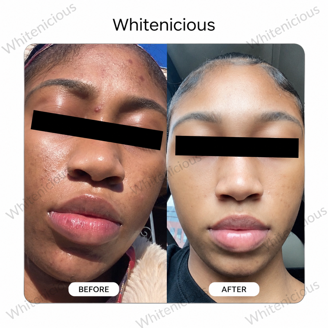 Baddie Skin Elixir