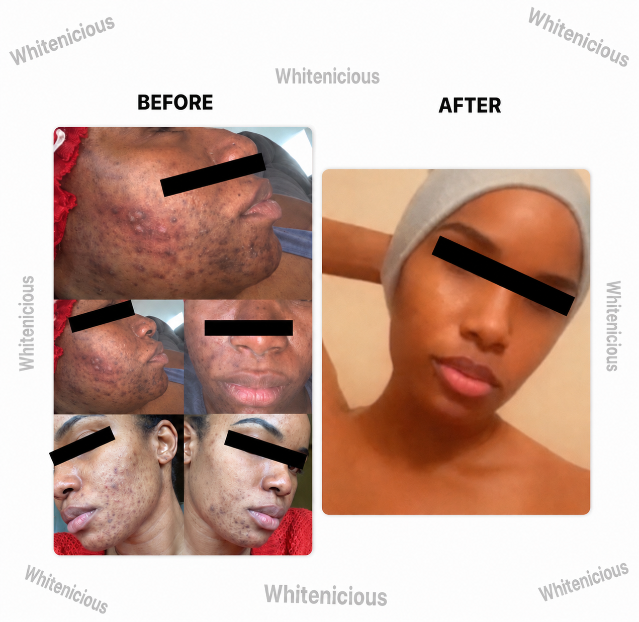 Baddie Skin Elixir