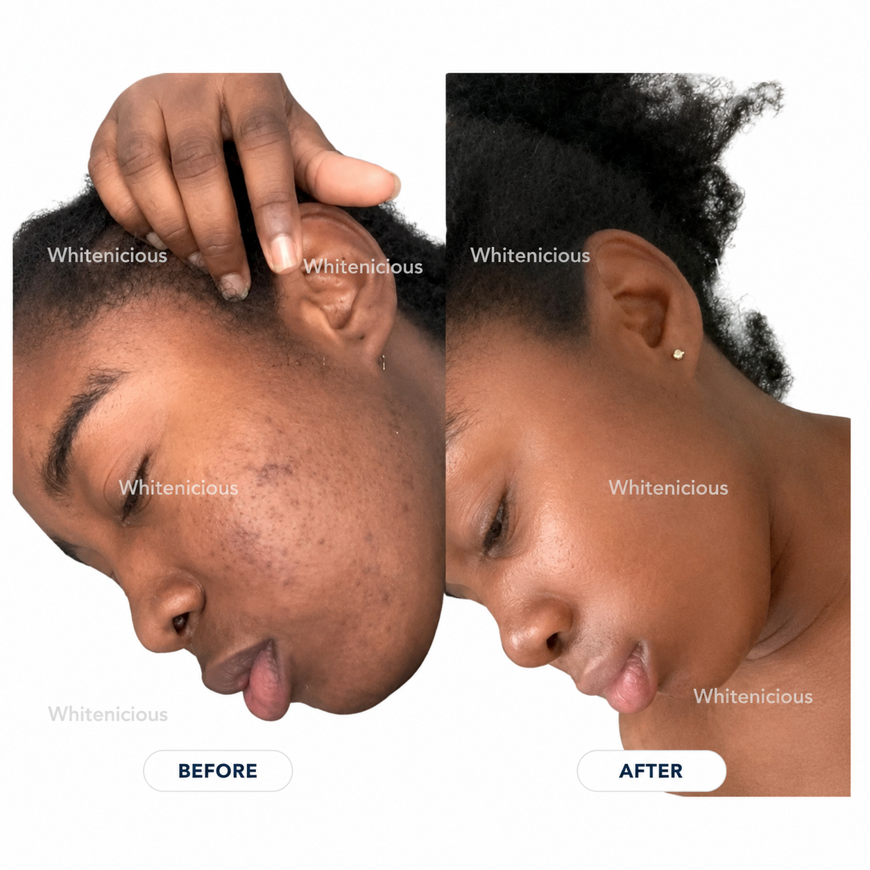 Baddie Skin Elixir