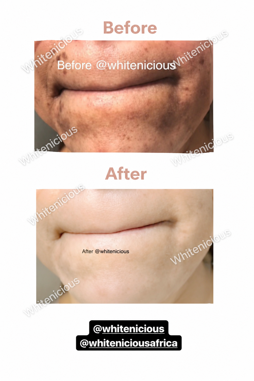 Baddie Skin Elixir