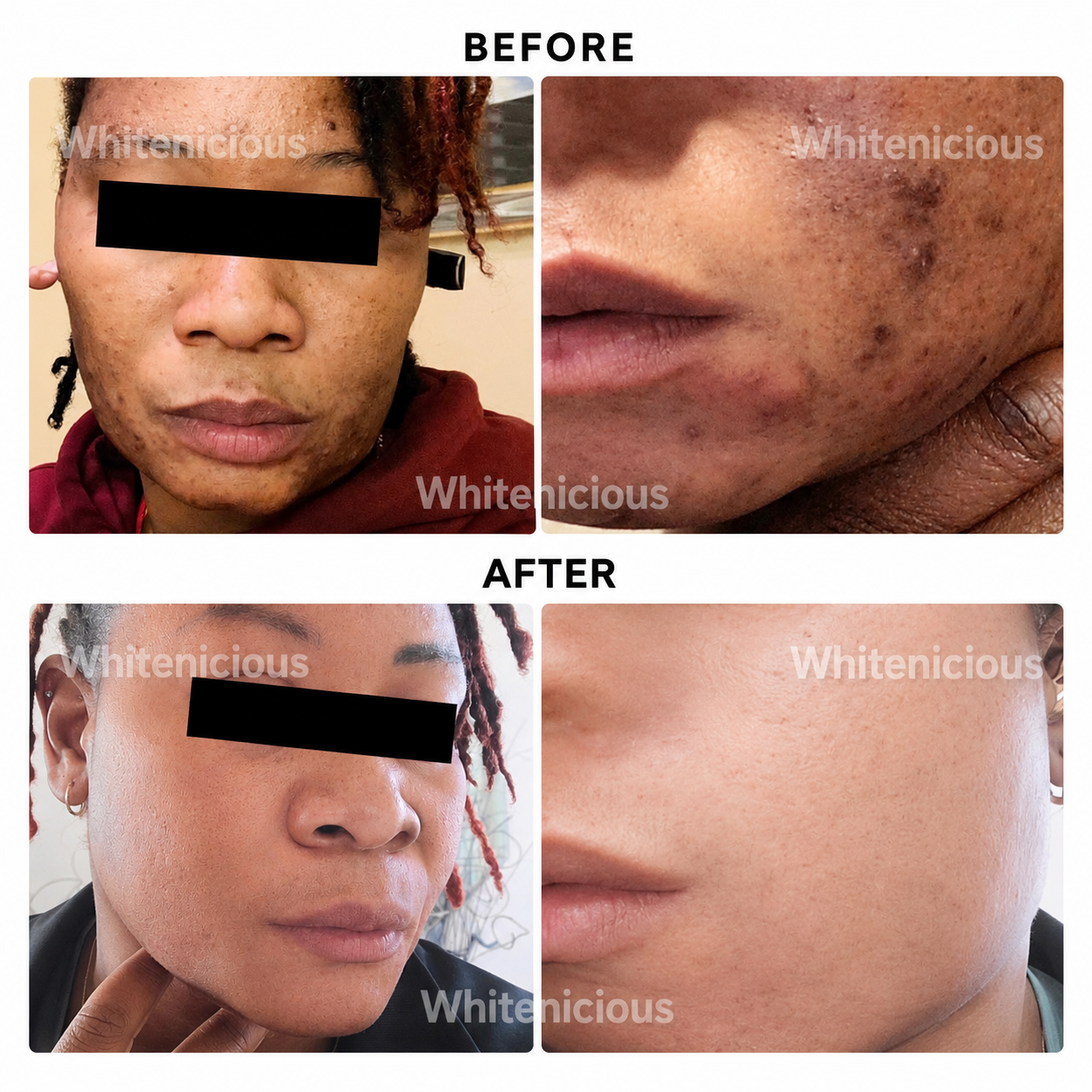 Baddie Skin Elixir