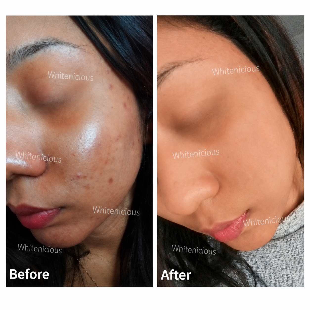 Baddie Skin Elixir
