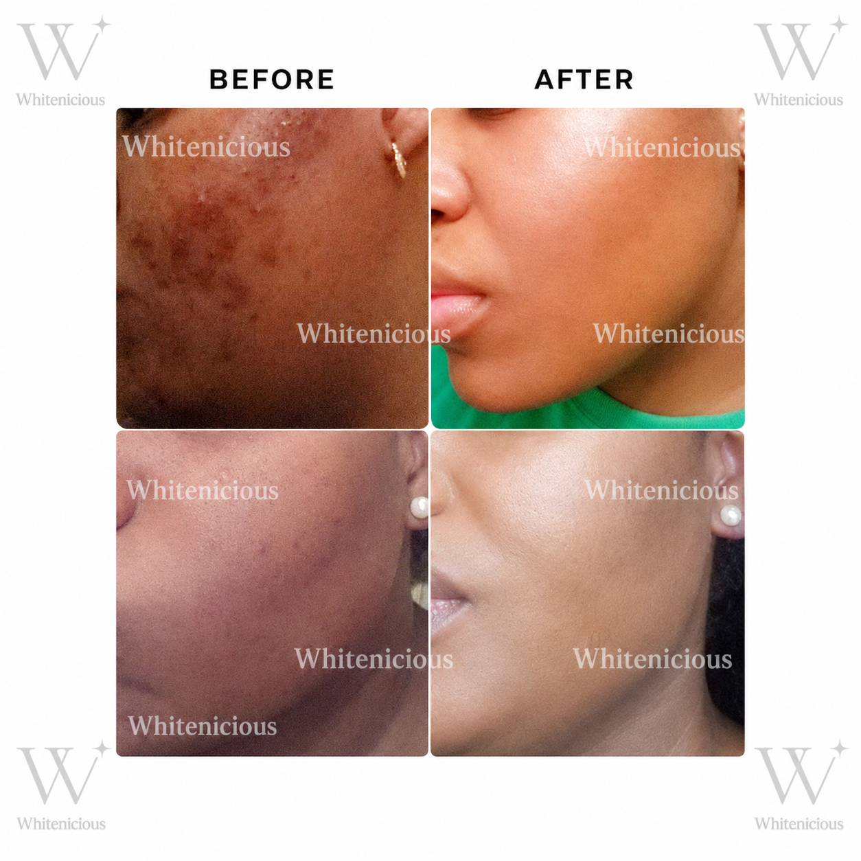 Baddie Skin Elixir