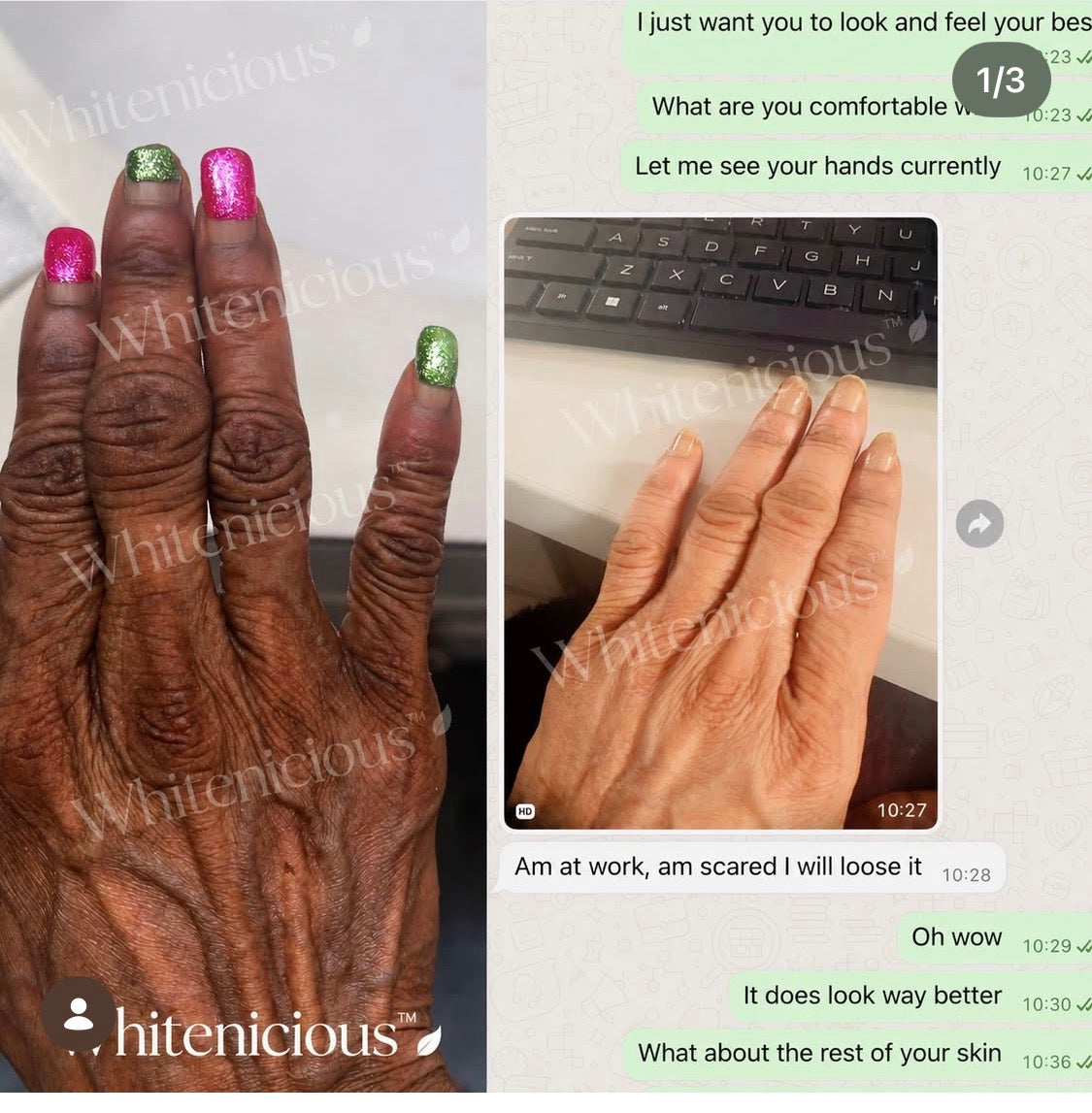 Skin Whitening Shot IntraVitamin