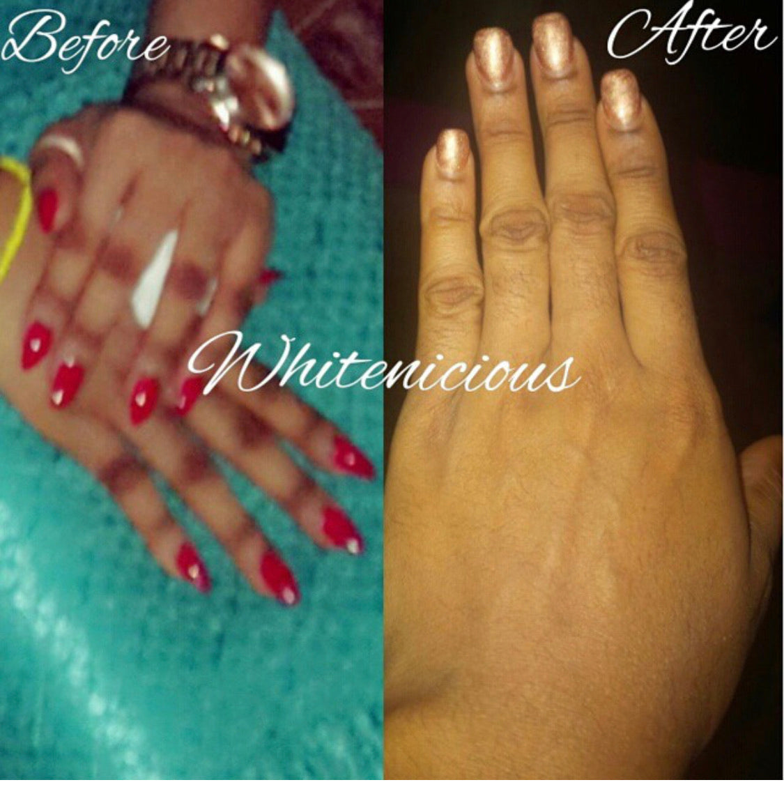 Dark Knuckles Cream | Snow White Knuckles Cream | Whitenicious