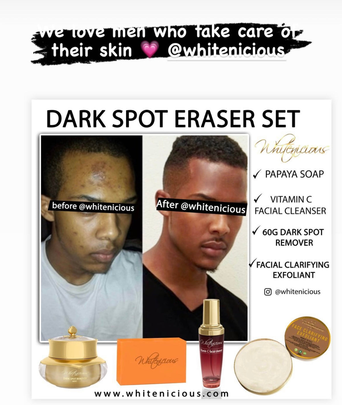 Dark Spot Eraser Set – Whitenicious By Dencia