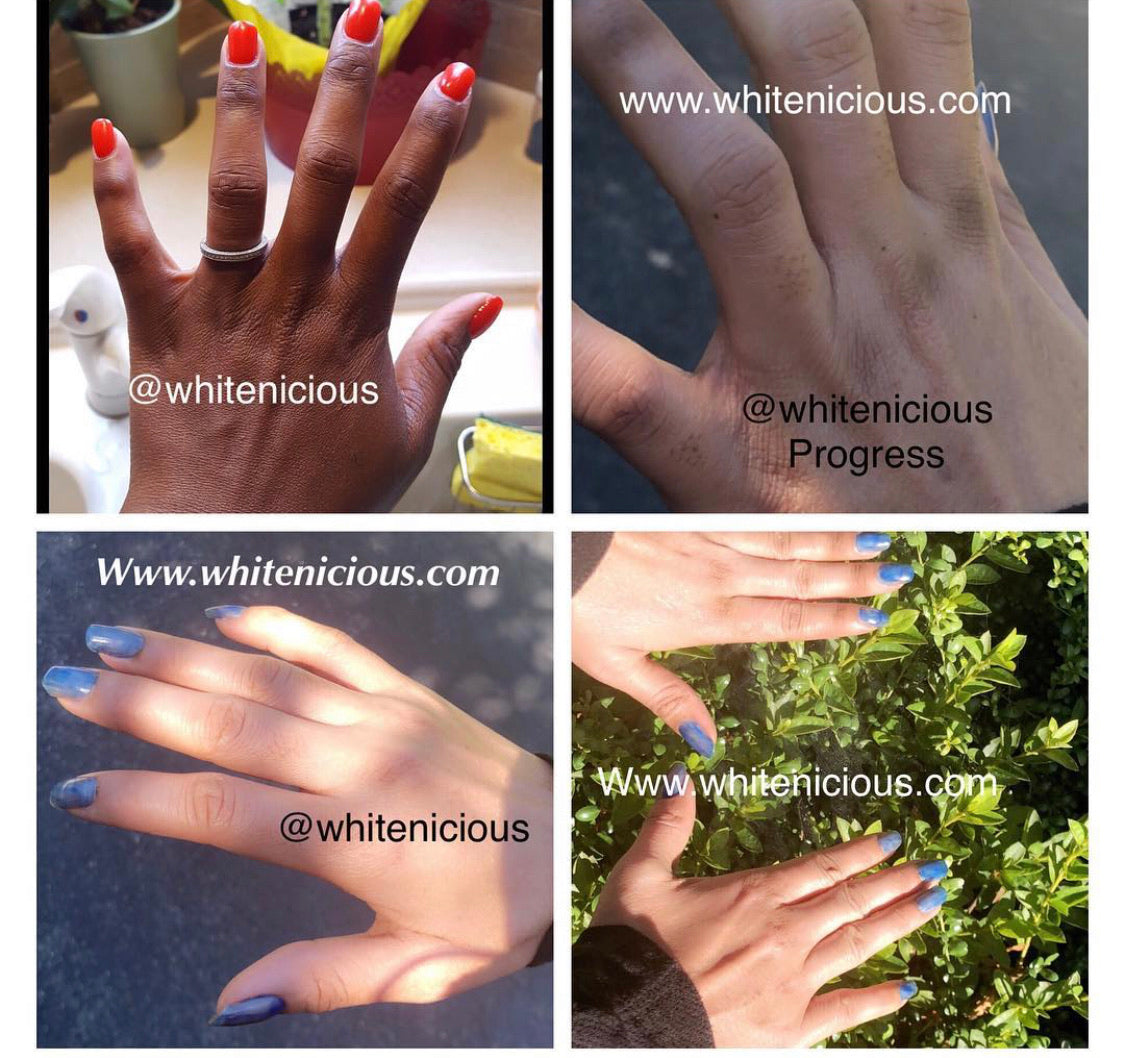 Dark Knuckles Cream | Snow White Knuckles Cream | Whitenicious